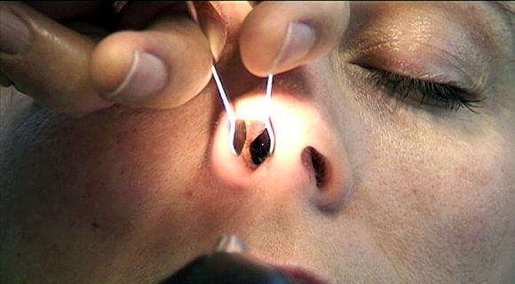 Ear, Nose and Throat (ENT) examination