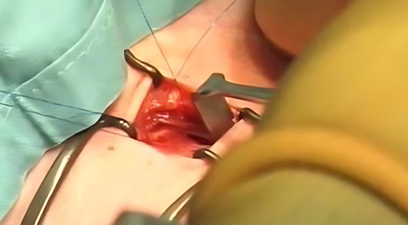 Paediatric respiratory examination